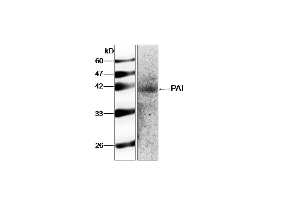 IHC-plus™ SERPINE1 / PAI-1 Antibody