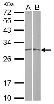 Polyclonal Rabbit anti-Human MRPL19 Antibody (WB)