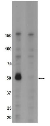 PTK6 / BRK Antibody (phospho-Tyr342)