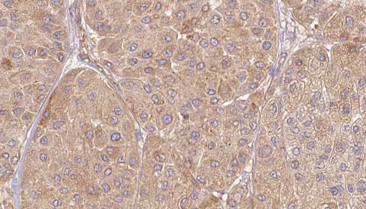 Polyclonal Rabbit anti-Human ELSPBP1 / HE12 Antibody (IHC, IF, WB)
