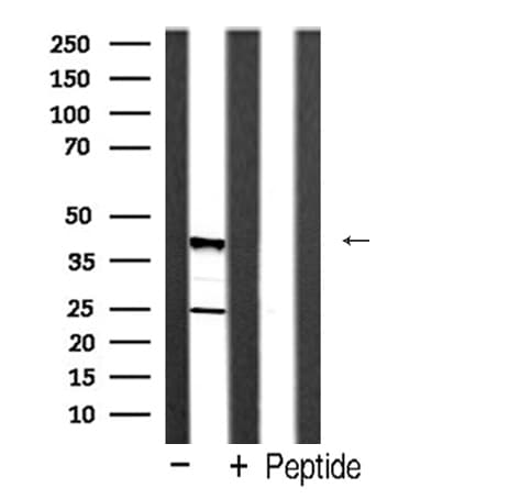CASP4 / Caspase 4 Antibody (Cleaved Gln81)