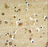 GABRD Antibody (aa331-358)