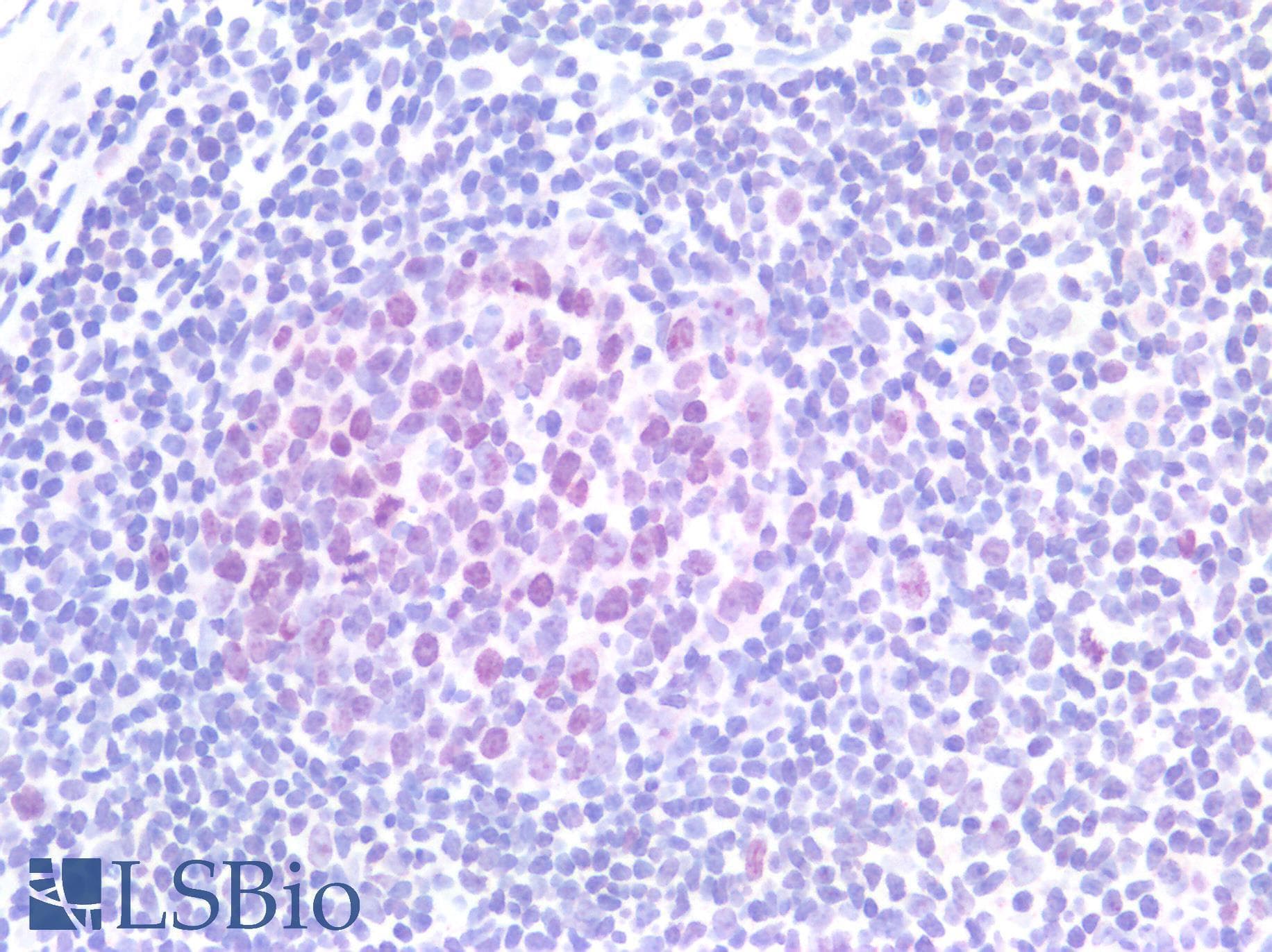 IHC-plus™ TOP2A / Topoisomerase II Alpha Antibody