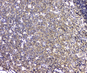 LCP1 / L-Plastin Antibody