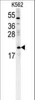PMCH / MCH Antibody (aa94-122)