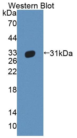 ABCB11 / BSEP Antibody (aa421-663, Biotin)