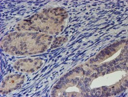 RPS6KB1 / P70S6K / S6K Antibody (clone OTI1G4, Carrier-free)