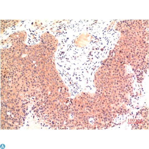TUBE1 / Tubulin Epsilon Antibody