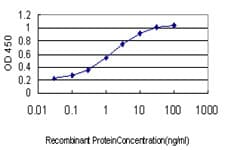 IHC-plus™ SPRY1 / Sprouty 1 Antibody (clone 3H4)