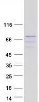 Human SRPR Protein (Recombinant Myc-DDK (Flag))