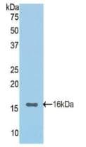 CDH1 / E Cadherin Antibody (aa155-266)