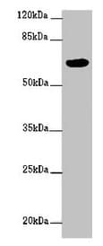 Polyclonal Rabbit anti-Human FBXW5 Antibody (IHC, IF, WB)