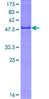 Human LRAT Protein (Recombinant GST)
