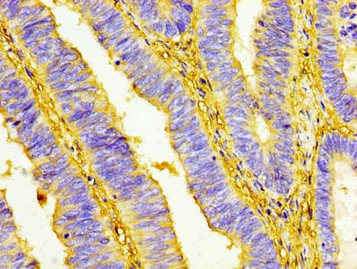 UCP1 / UCP-1 Antibody