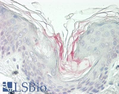 IHC-plus™ NKG2DL4 / ULBP4 Antibody