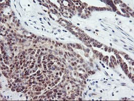 TIMP2 Antibody (clone OTI1B11, Carrier-free)