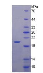 Human Beta-N-Acetylglucosaminidase Protein (Recombinant His)