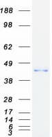 Human GNAT2 Protein (Recombinant Myc-DDK (Flag))