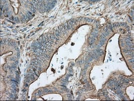 ALDH3A1 Antibody (clone 1B6, Carrier-free)