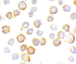 SIGIRR Antibody (C-Terminus)