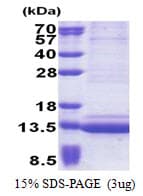 Human EPGN / Epigen Protein (Recombinant His)