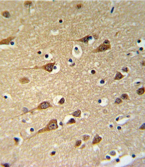 Aspartate Aminotransferase Antibody (aa352-381)
