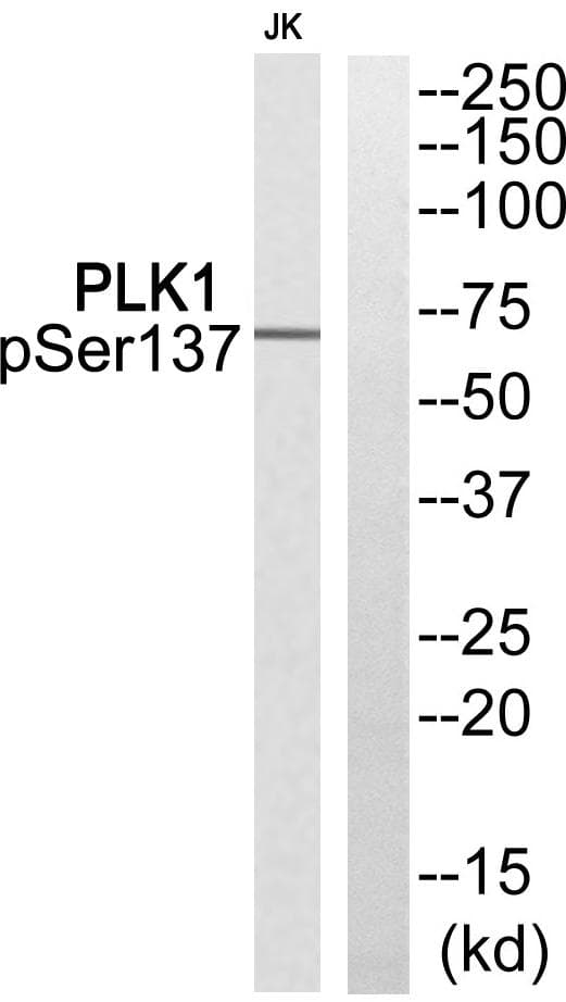 Polyclonal Rabbit anti-Human PLK1 / PLK-1 Antibody (phospho-Ser137, WB)
