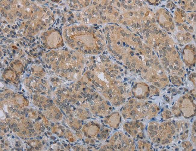 CLEC1A / CLEC-1 Antibody