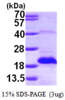 Human MSRB2 / MSRB Protein (Recombinant His)