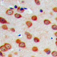 Polyclonal Rabbit anti-Human CYP26C1 Antibody (N-Terminus, IHC, WB)