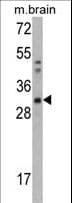 CAPZB / CAPZ Beta Antibody (aa229-257)