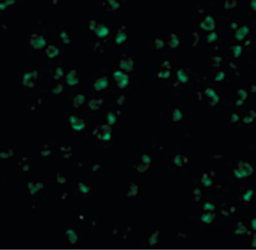 IHC-plus™ Polyclonal Rabbit anti-Human MAP3K5 / ASK1 Antibody (IHC, IF, WB)