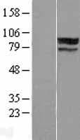 ZNF710 Protein (Over-Expression Lysate Myc-DDK (Flag))