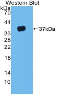 LRG1 / LRG Antibody (aa37-340)