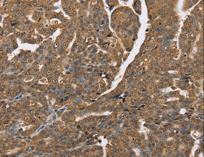 Polyclonal Rabbit anti-Human PTPN20 Antibody (IHC)