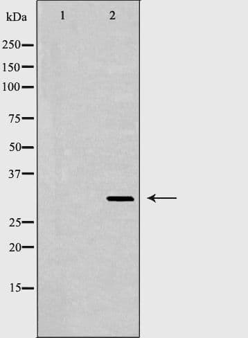 Polyclonal Rabbit anti-Human IL1A / IL-1 Alpha Antibody (IHC, WB)