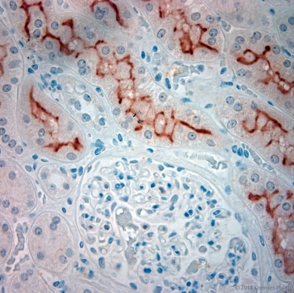 SLC5A8 / AIT Antibody (aa560-610)