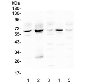 METTL3 Antibody