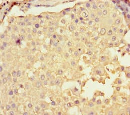 CPNE2 Antibody