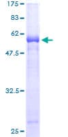 Human MPPED1 Protein (Recombinant GST)