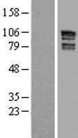 ARHGAP17 / NADRIN Protein (Over-Expression Lysate Myc-DDK (Flag))