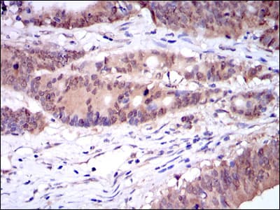 Monoclonal Mouse anti-Human CASP8 / Caspase 8 Antibody (clone 1H11, IHC, WB)