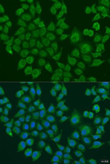 Polyclonal Rabbit anti-Human BLOC1S2 Antibody (IF)