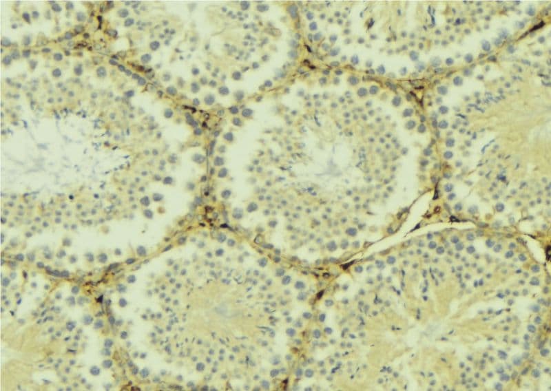 STMN1 / Stathmin / LAG Antibody