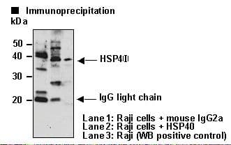 DNAJB1 / Hsp40 Antibody (clone 2E1)