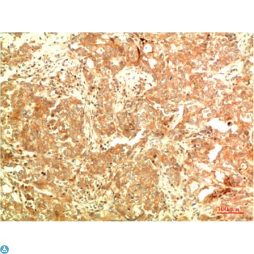 APG5 / ATG5 Antibody