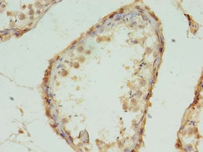 Polyclonal Rabbit anti-Human MRPL18 Antibody (IHC, WB)