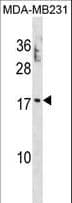 Polyclonal Rabbit anti-Human PTRH2 / BIT1 Antibody (aa26-55, WB)