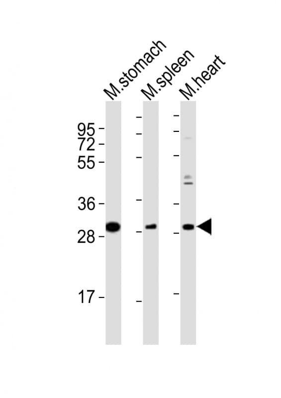 NKX2-5 Antibody (aa98-133)