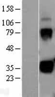 KLK1 / Kallikrein 1 Protein (Over-Expression Lysate Myc-DDK (Flag))